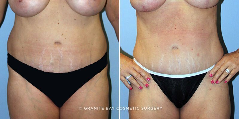 Case # 130 after photo