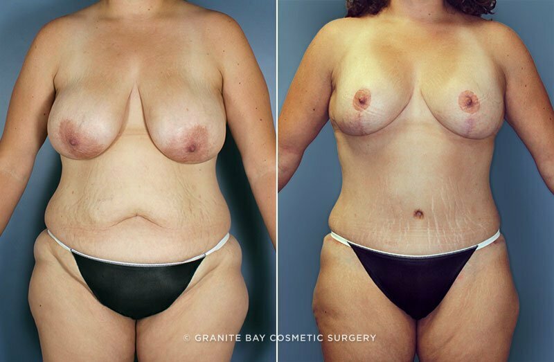 Case # 70 after photo