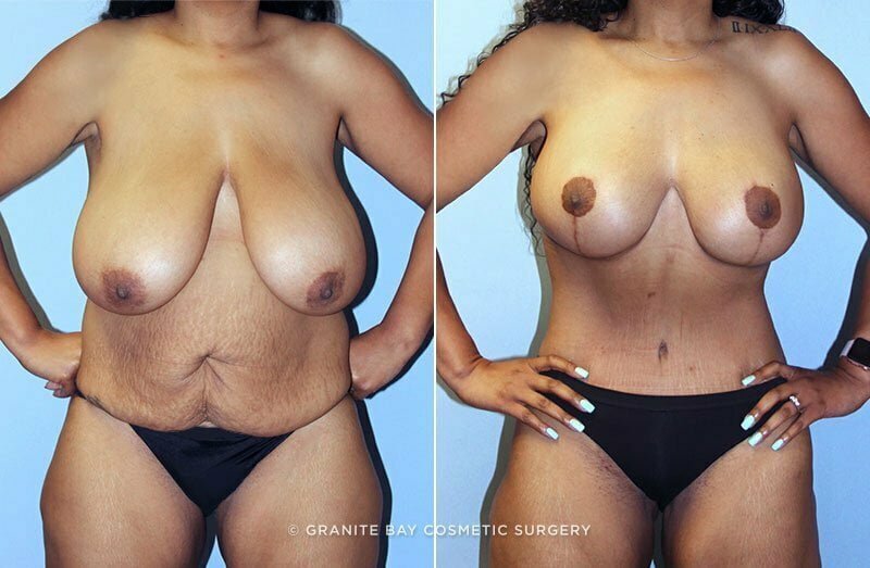 Case # 71 after photo