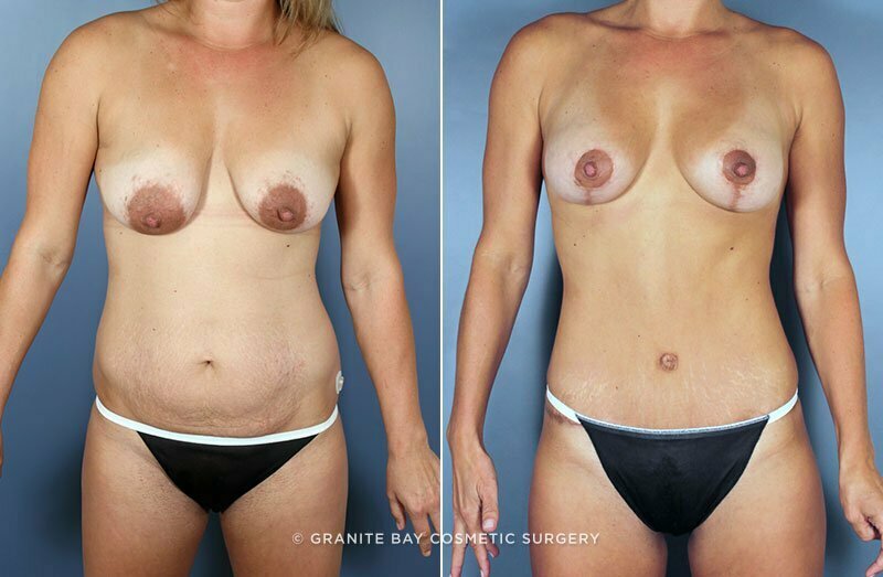 Case # 73 after photo