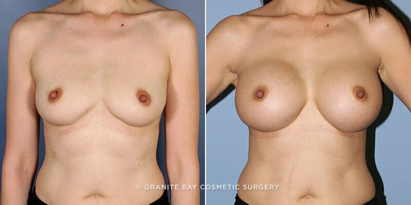 Case # 139 after photo