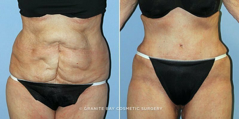 Case # 131 after photo