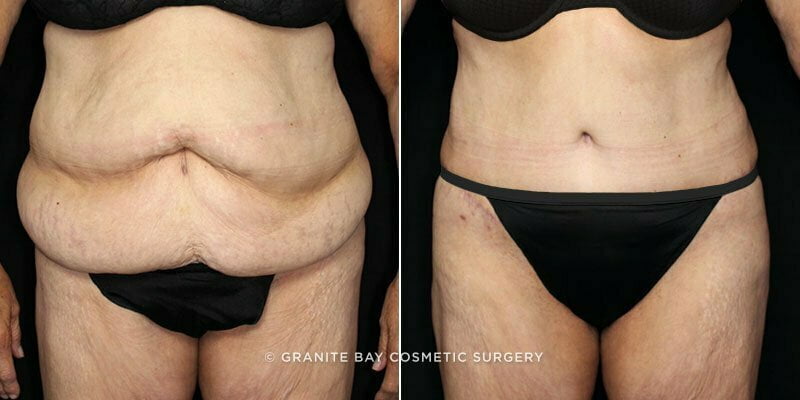 Case # 133 after photo