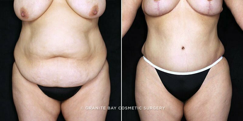 Case # 134 after photo