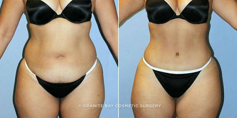 Case # 135 after photo