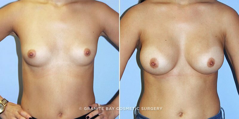 Case # 146 after photo