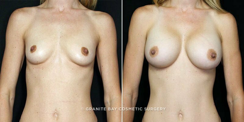 Case # 147 after photo