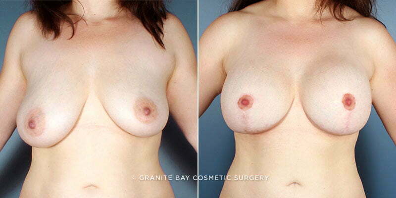 Case # 52 after photo