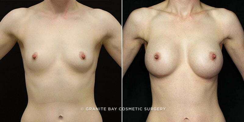 Case # 149 after photo