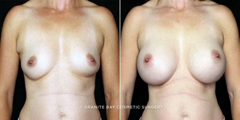 Case # 157 after photo