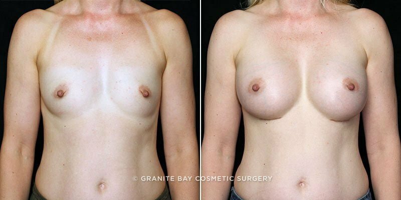 Case # 159 after photo