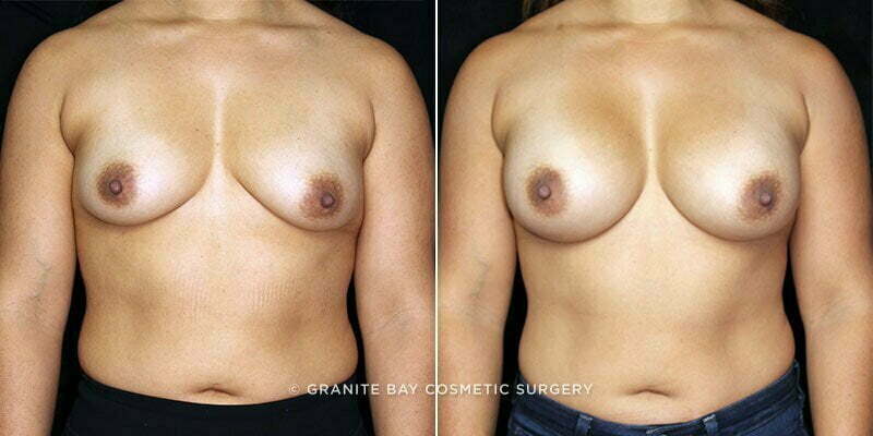 Case # 163 after photo