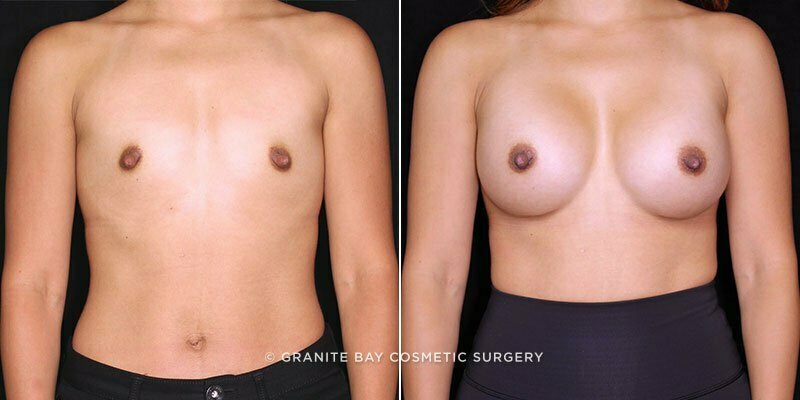 Case # 167 after photo