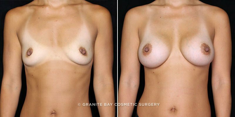 Case # 168 after photo