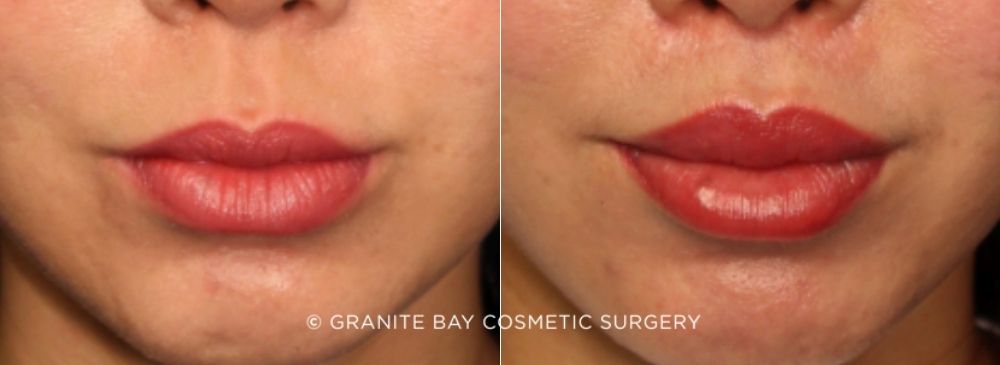 Case # 2 before photo