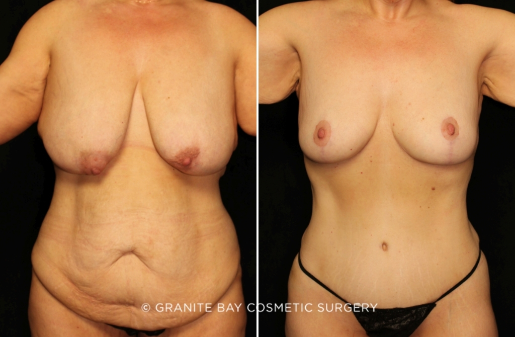 Case # 76 before photo