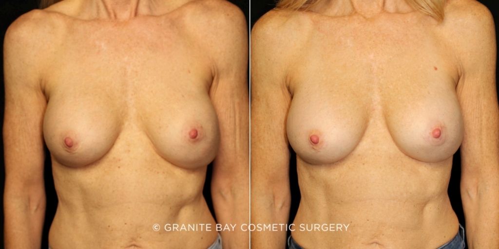 Case # 87 before photo