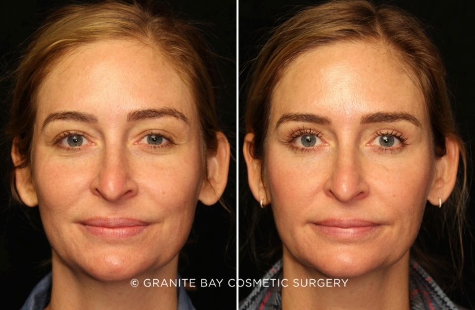 Case # 16 before photo