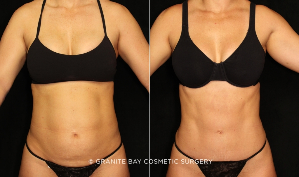 Case # 136 before photo